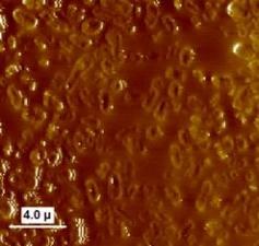 灭活菌 E. coli treated