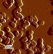 活菌 Untreated E. coli